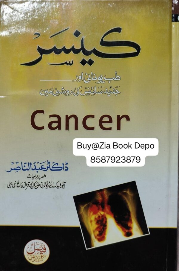 Cancer Tibb e Unani